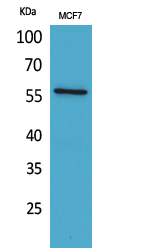 WB - ALK-1 Polyclonal Antibody AP73365